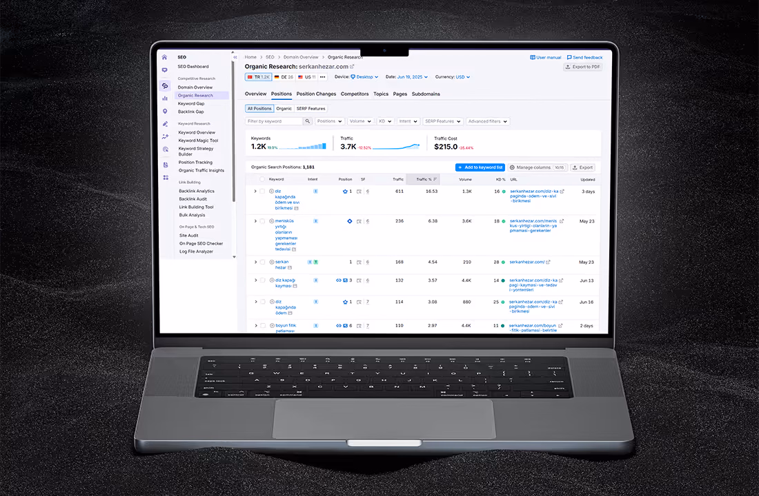 The SEO performance dashboard for Op. Dr. Serkan Hezar's site, on a laptop